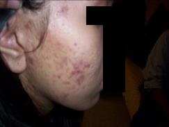 img1